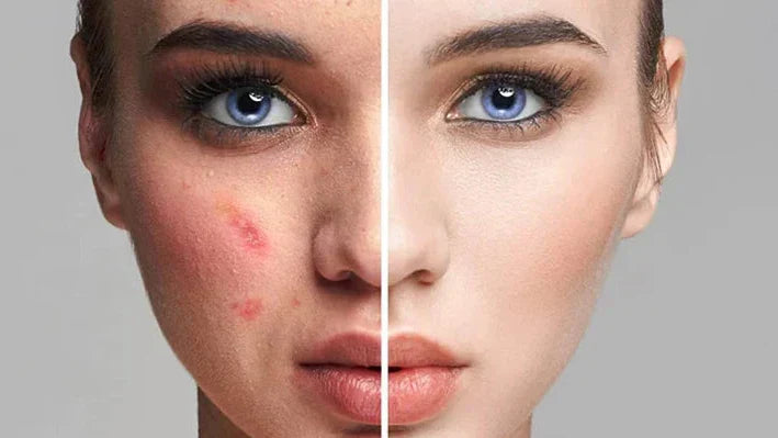 SkinGlow Base - Magic Foundation